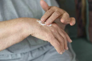 winter wound prevention erie including an older person's hands while applying moisturizer.