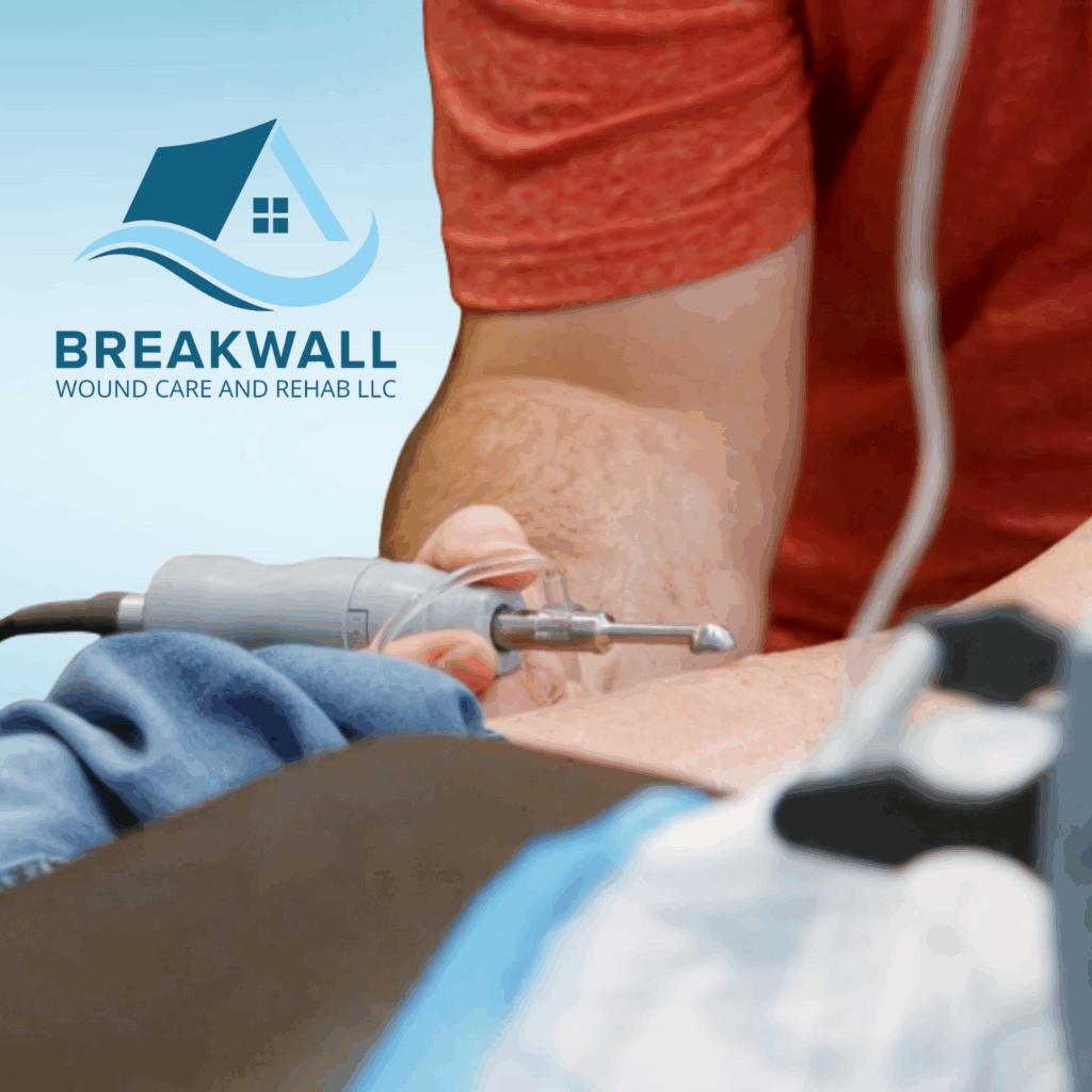 mist therapy wound mist ultrasound wand being used over a leg wound to heal the wound faster during erie pa in home physical therapy